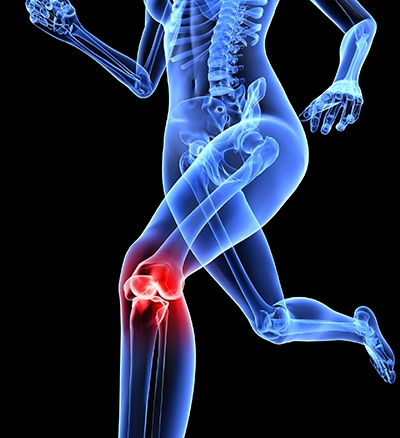 Exercise for knee pain